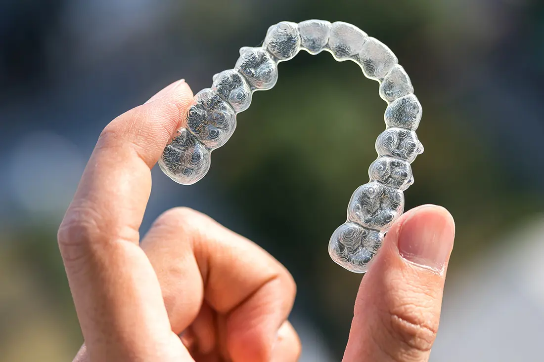 Invisalign clear aligners